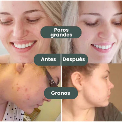 MascarillaGREEN™ - Mascarilla en Barra con Extracto de Té Verde