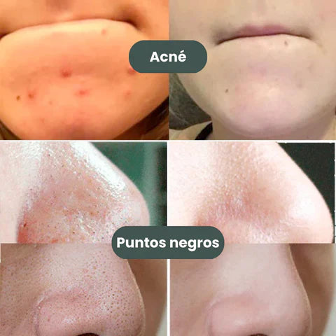 MascarillaGREEN™ - Mascarilla en Barra con Extracto de Té Verde